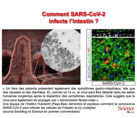 Pour comprendre l'attaque intestinale